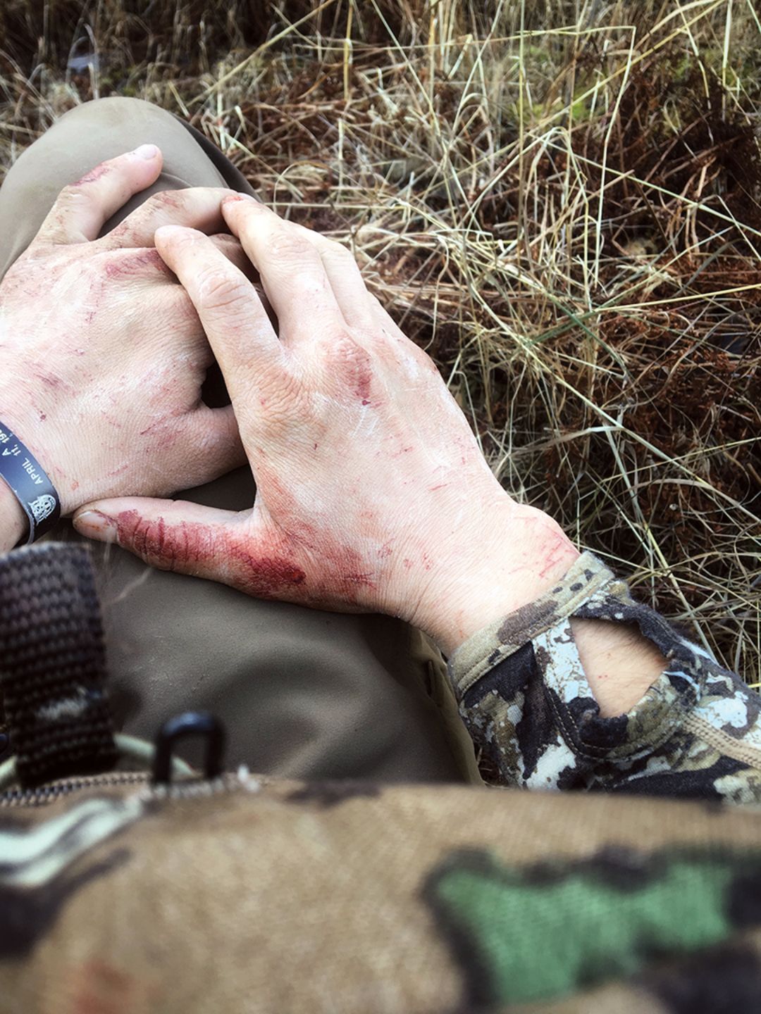 The punished hands of a rookie goat hunter.